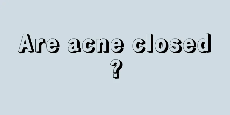 Are acne closed?