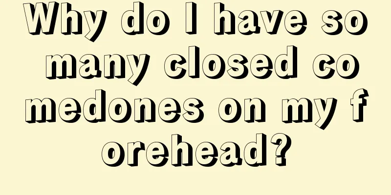 Why do I have so many closed comedones on my forehead?