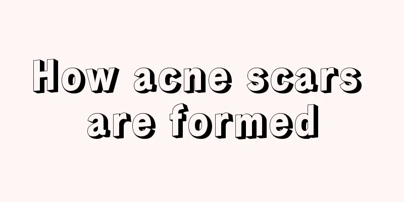 How acne scars are formed