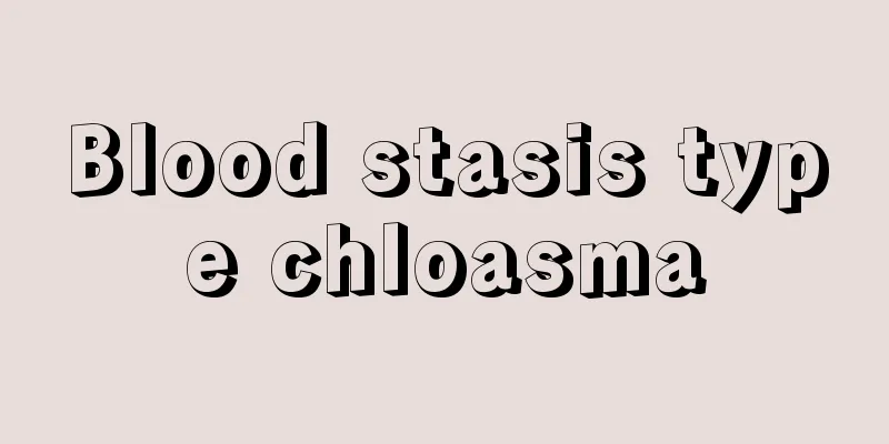 Blood stasis type chloasma