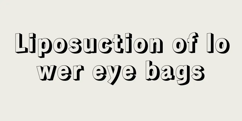 Liposuction of lower eye bags