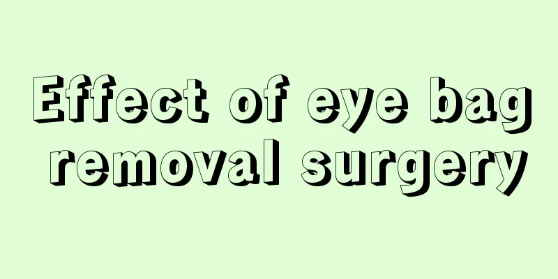 Effect of eye bag removal surgery