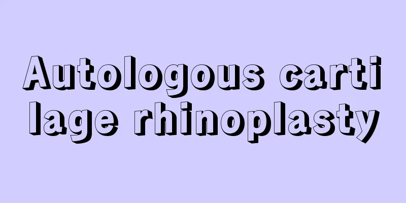 Autologous cartilage rhinoplasty