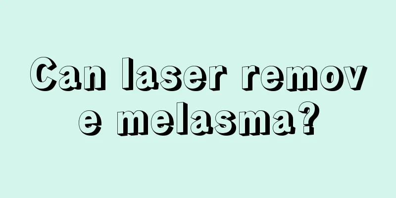 Can laser remove melasma?