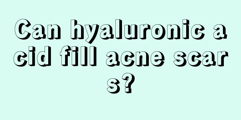 Can hyaluronic acid fill acne scars?