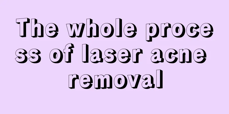 The whole process of laser acne removal