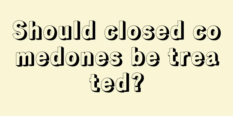 Should closed comedones be treated?