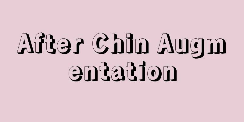 After Chin Augmentation