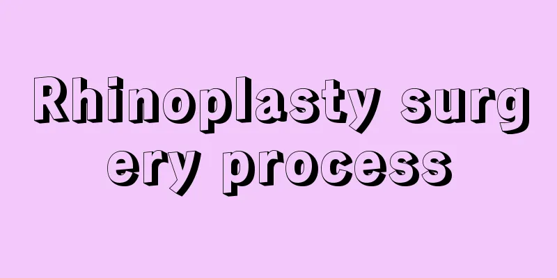 Rhinoplasty surgery process