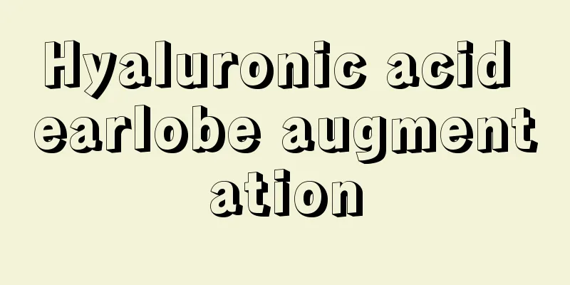 Hyaluronic acid earlobe augmentation