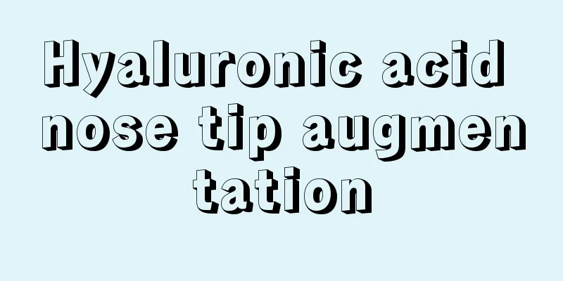 Hyaluronic acid nose tip augmentation