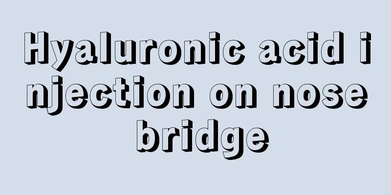 Hyaluronic acid injection on nose bridge