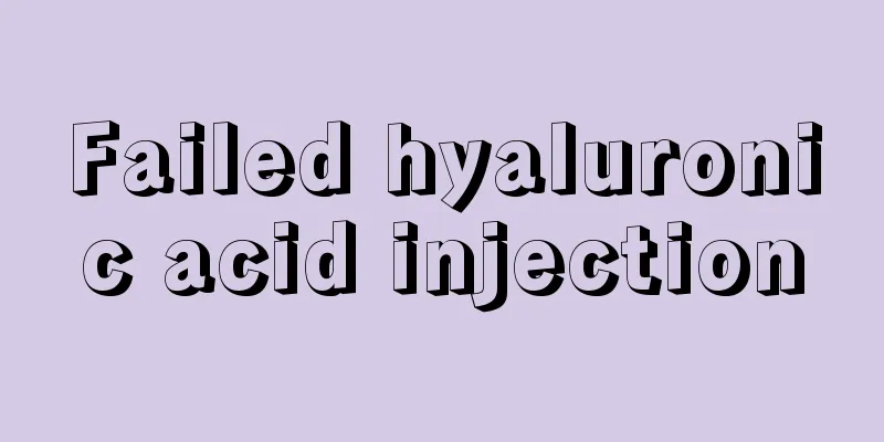 Failed hyaluronic acid injection