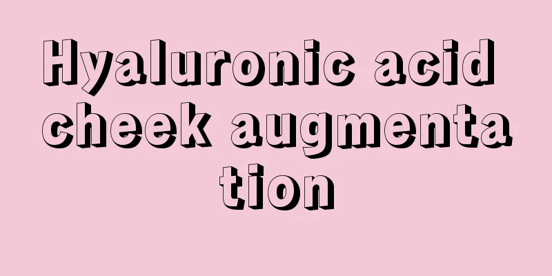 Hyaluronic acid cheek augmentation