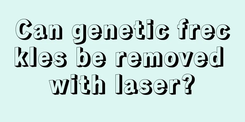 Can genetic freckles be removed with laser?