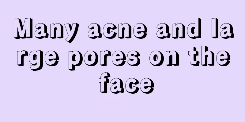 Many acne and large pores on the face