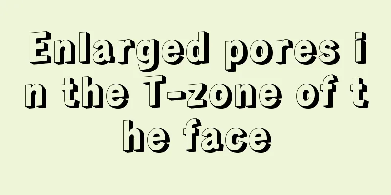 Enlarged pores in the T-zone of the face