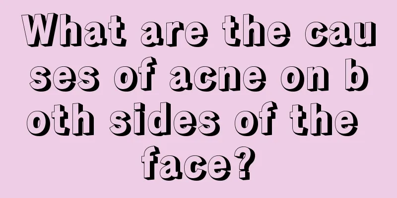 What are the causes of acne on both sides of the face?