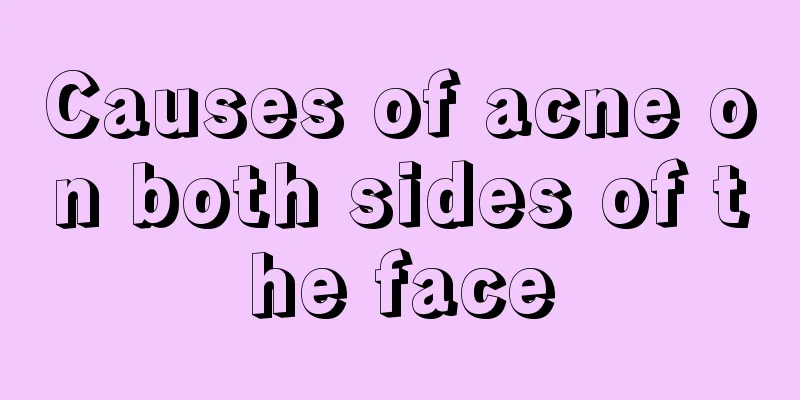 Causes of acne on both sides of the face