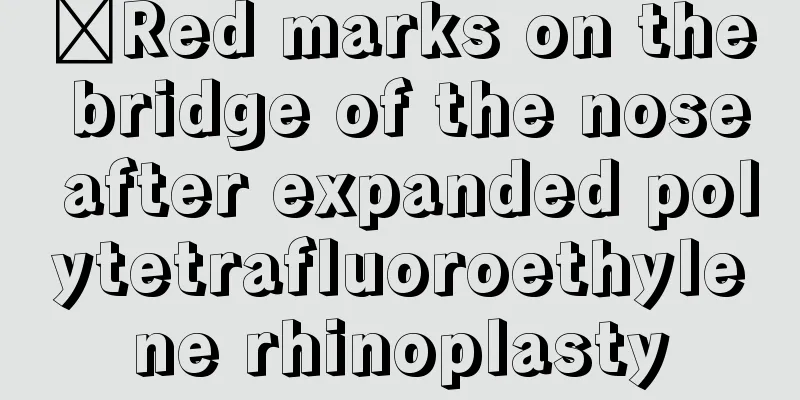 ​Red marks on the bridge of the nose after expanded polytetrafluoroethylene rhinoplasty