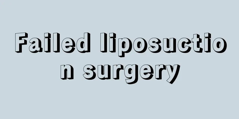 Failed liposuction surgery