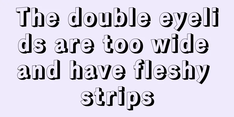 The double eyelids are too wide and have fleshy strips