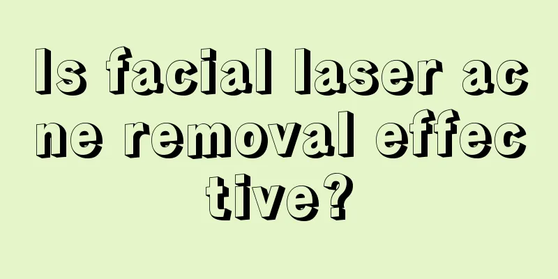 Is facial laser acne removal effective?