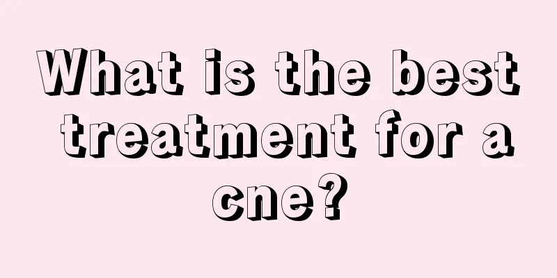 What is the best treatment for acne?