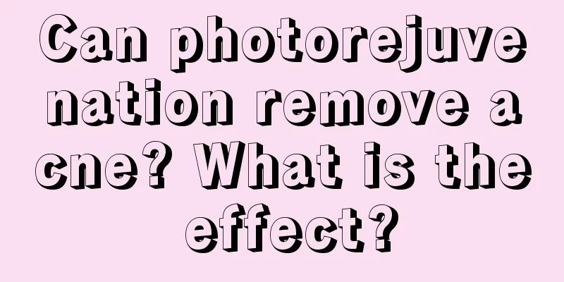 Can photorejuvenation remove acne? What is the effect?