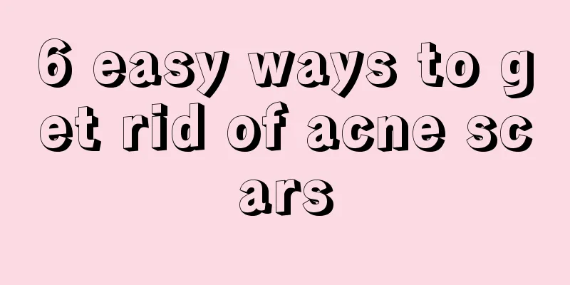 6 easy ways to get rid of acne scars