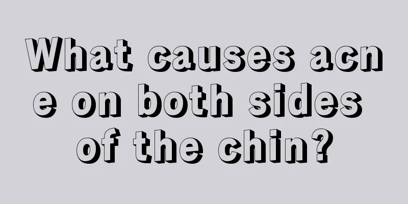 What causes acne on both sides of the chin?