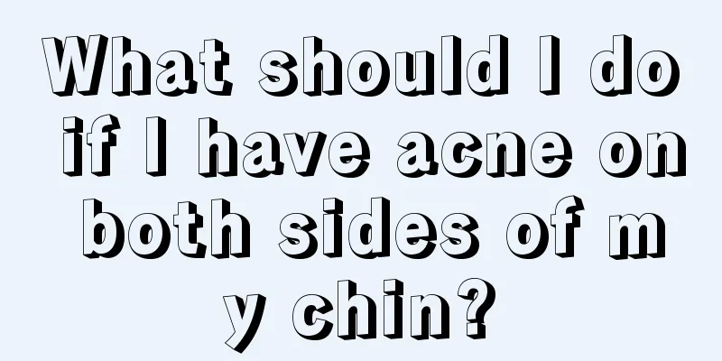 What should I do if I have acne on both sides of my chin?