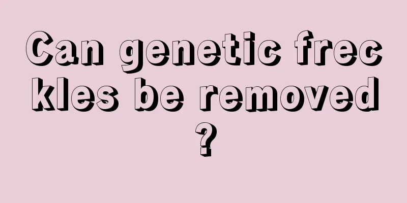 Can genetic freckles be removed?