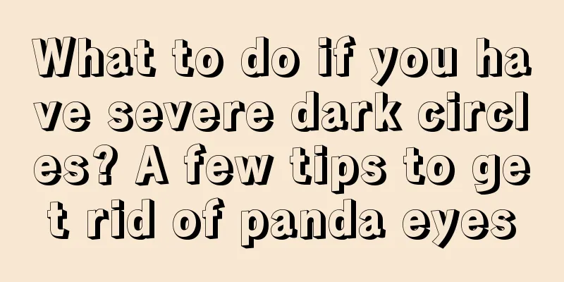 What to do if you have severe dark circles? A few tips to get rid of panda eyes