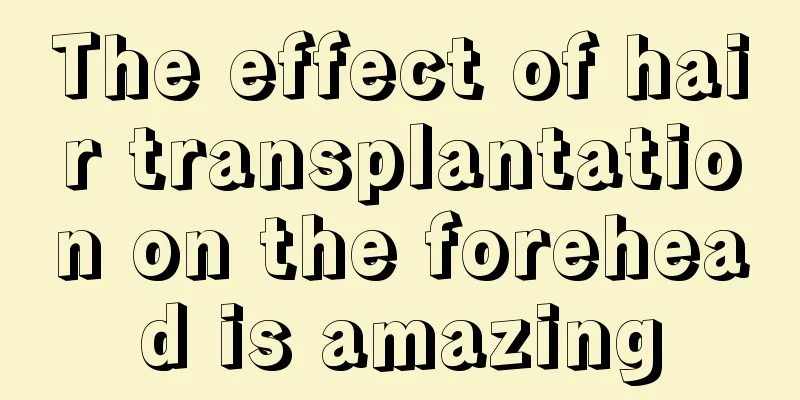 The effect of hair transplantation on the forehead is amazing