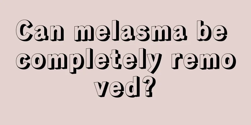 Can melasma be completely removed?