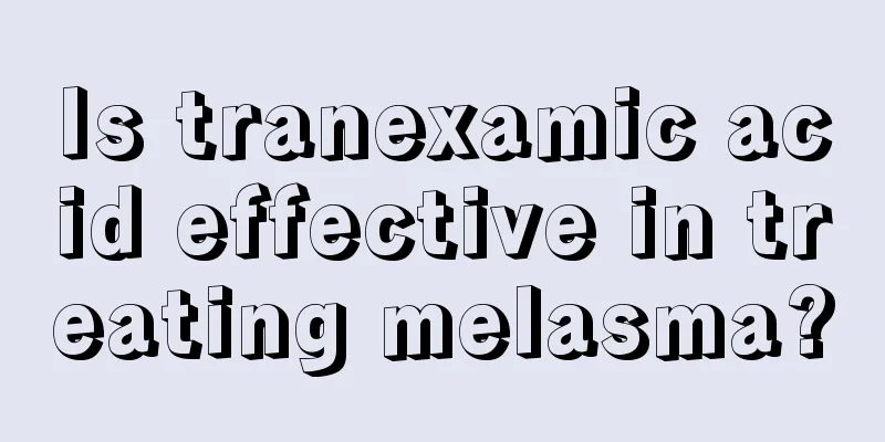 Is tranexamic acid effective in treating melasma?