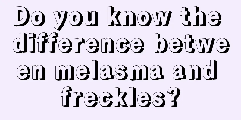 Do you know the difference between melasma and freckles?