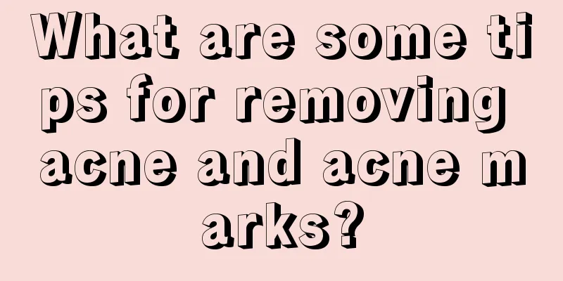 What are some tips for removing acne and acne marks?