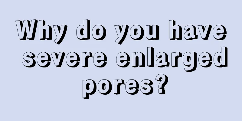 Why do you have severe enlarged pores?