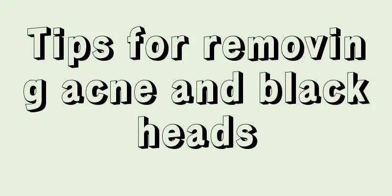 Tips for removing acne and blackheads