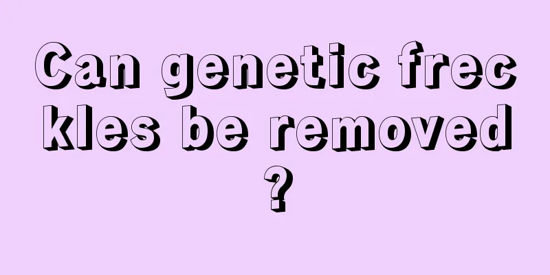 Can genetic freckles be removed?