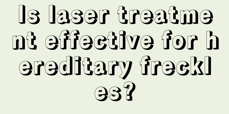 Is laser treatment effective for hereditary freckles?