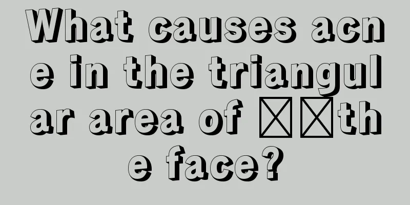 What causes acne in the triangular area of ​​the face?