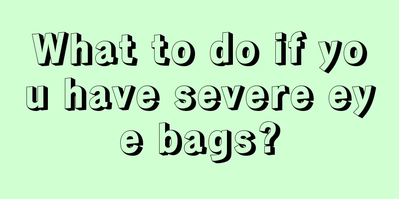 What to do if you have severe eye bags?