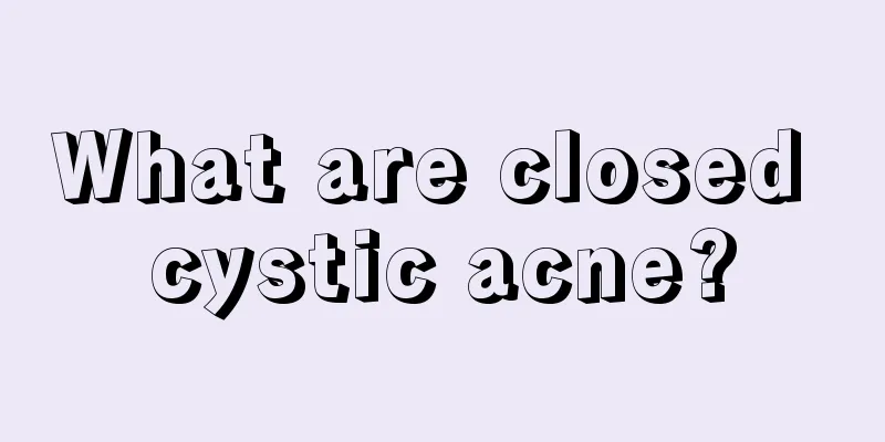 What are closed cystic acne?