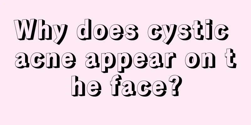 Why does cystic acne appear on the face?