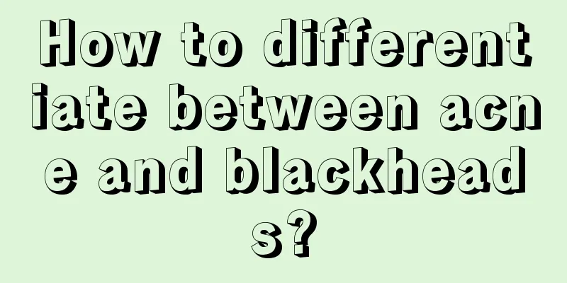 How to differentiate between acne and blackheads?