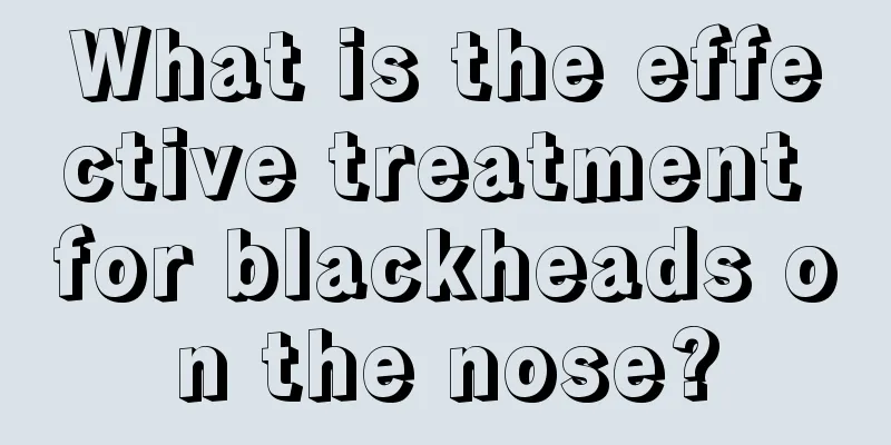 What is the effective treatment for blackheads on the nose?