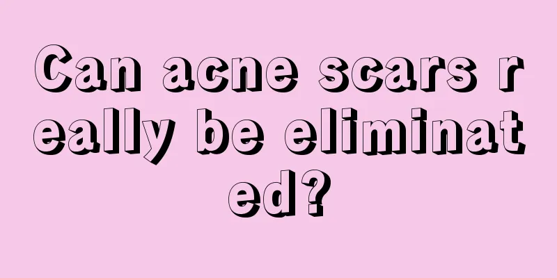 Can acne scars really be eliminated?